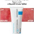 La Roche Posay Cicaplast Baume B5+ Ultra Reparing Soothing Balm 100ml_5